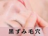 【黒ずみ毛穴】毛穴吸引付つるんとツヤ肌フェイシャル(デコルテ込)