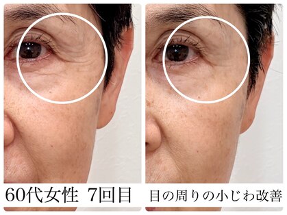 美容整体 ソワンの写真