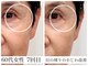 美容整体 ソワンの写真