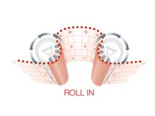 エルクレスト 代々木公園店/皮膚を持上げ３D立体施術,その１