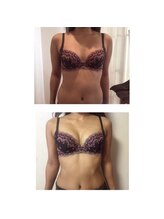 カレン(KAREN)/徹底！脂肪増量バストアップ！