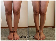サロン ド アール(salon de R.)/【脚足骨氣・50代・施術効果】