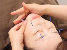 本多鍼灸整骨院なみき院