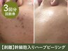 【3回回数券】ハーブピーリング(剥離)※初回以降も1回あたり9800円