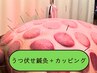 【鍼灸＋無数のカッピング(うつ伏せのみ)】15日以上空いた、初回同料金、再検