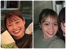 パルティール 渋谷店 partir/パスリルで小顔に！