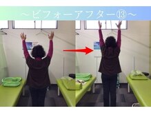 ケアるら整骨院 富里院/ビフォーアフター
