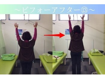 ケアるら整骨院 富里院/ビフォーアフター