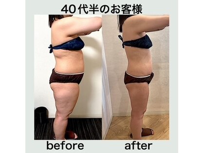 エステサロンクオーツの写真