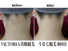 マイン イオンモール浜松市野店/速くて痛みが少ない美肌脱毛！