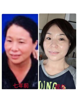 ハナノ整体院/確実に若くなって来た自分