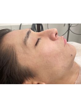 メンズフェイシャル