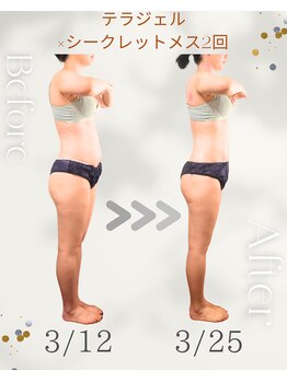 ナチュラルボディラボ 草津店/テラヘルツジェル×120分