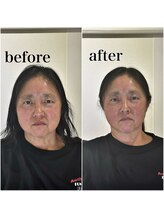 エメ 倉敷店(Aimer)/骨格補正ヘッドスパ 小顔矯正