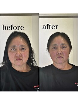 エメ 倉敷店(Aimer)/骨格補正ヘッドスパ 小顔矯正