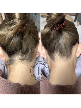 ブラジリアンワックス脱毛サロン ルラ 恵比寿(Lula)/うなじワックス/襟足脱毛