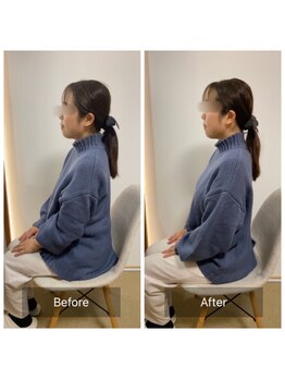 チル(Chill.)/美容整体 6