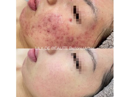 リリードボーテ 高槻店(LILY DE BEAUTE)の写真