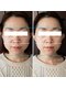 きしの美容整体院の写真/【老廃物を流してスッキリ小顔に◎】美容整体院が施術する本格小顔エステ/年齢による"たるみ"が気になる方