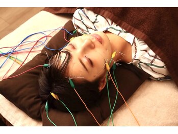 芦屋楓鍼灸院/たるみ/むくみ改善に美容鍼☆