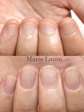 マリーロール 梅田店(Marie Laure)/深爪矯正/自爪育成/自爪風