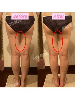 アユスリム(AYU SLIM)/一回でも変化できるの充実痩身