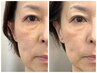 【 New 】全てのシワに特化した美肌育成ピーリング 即日艶ピカ仕上げ♪ 