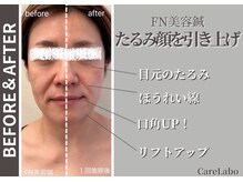 ケアラボ(Care Labo)