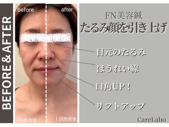 ケアラボ(Care Labo)