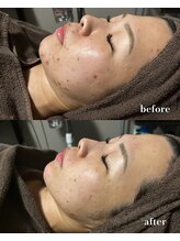 ヴィアージュ(Viage)/塗る金の糸７回目