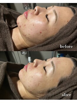 ヴィアージュ(Viage)/塗る金の糸7回目