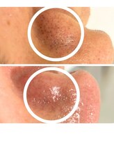 ハクビューティー(HAKU BEAUTY)/実は毛だった？