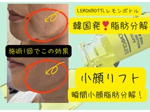 ウェリナベル(WelinaBelle)の雰囲気（韓国話題！レモンボトル！二重あご・たるみ脂肪、スッキリ小顔へ）