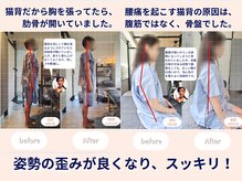 ヴェリタス(VERITAS)の雰囲気（姿勢改善。1回、二回の比較的症状が軽い方の変化はこちら）