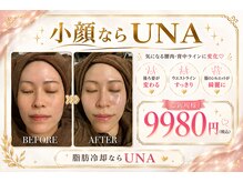 ウナトゥルービューティー(UNA true beauty)の雰囲気(UNAで小顔、タイトニング、肌管理お任せください!)
