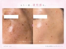 サロンサイ(salonsai)