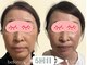 ヨサパーク リボーン(YOSA PARK Reborn)の写真/全身痩身に加えて美容のスペシャリストによる小顔矯正×エイジングケア×美肌まで叶う★究極の美メソッド