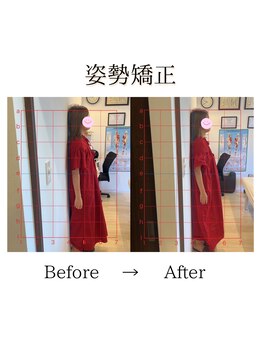 心斎橋長堀フェムテック整骨院/9姿勢矯正　骨格矯正と骨盤矯正