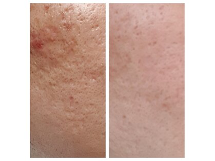 ソワンドゥース ヴェール(Soin douse Vert)の写真