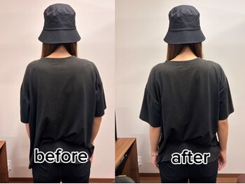 オン鍼灸整体院(ON鍼灸整体院)/整体/ビフォーアフター