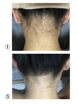 クサカンムリ(KUSAKANMURI)/女性うなじ