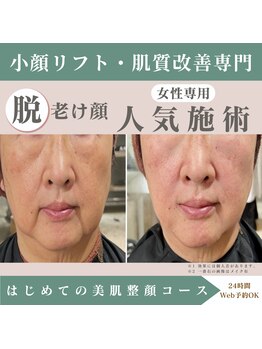 整顔院 経堂店の写真/小顔矯正たるみリフトで理想のフェイスラインへ☆憧れの小顔に導きます！