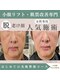 整顔院 経堂店の写真/小顔矯正たるみリフトで理想のフェイスラインへ☆憧れの小顔に導きます！