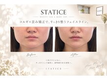 スターティス(STATICE)の雰囲気（エラ張り/毛穴/シワ/たるみ/くすみ/左右差/ニキビ/二重あご）