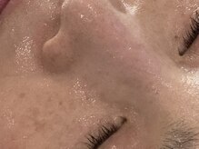 ノーブル シャット Noble Chate/つるんつるん！鼻の毛穴に注目！