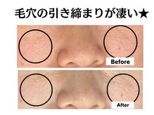 グレースティー 森町 箕面/毛穴に引き締まりが凄い！
