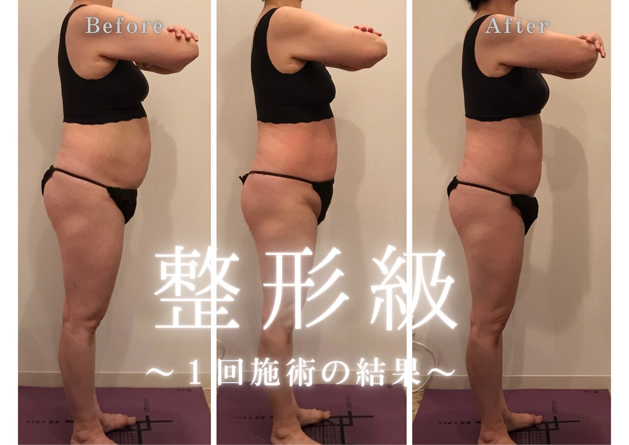 札幌市でエンダモロジーが人気のエステサロン｜ホットペッパービューティー