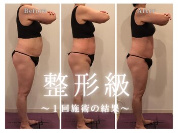 ミューゼルビューティー(MUSELLE BEAUTY)