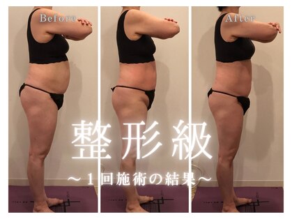 ミューゼルビューティー(MUSELLE BEAUTY)の写真