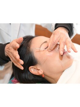 鍼灸施術を受けたい